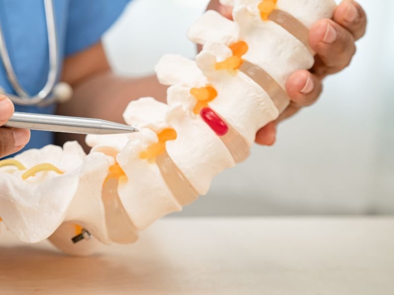Dor lombar crônica veja quando buscar neurocirurgião